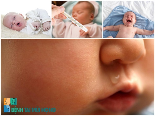 Dấu hiệu viêm mũi ở trẻ sơ sinh