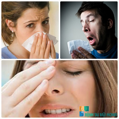 Viêm đa xoang thể cấp thường bị hắt hơi, sổ mũi và đau nhức