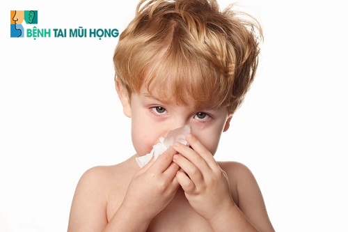 Viêm mũi xuất tiết thường bắt đầu với triệu chứng chảy nước mũi, hắt hơi, tắc mũi kéo dài