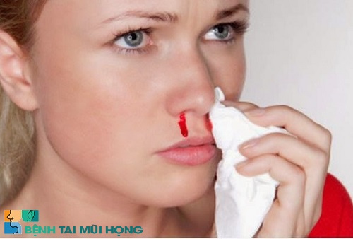 Chảy máu cam: Dấu hiệu nhận biết ung thu xoang mũi