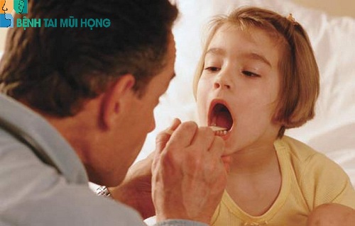 Biểu hiện viêm amidan ở trẻ em