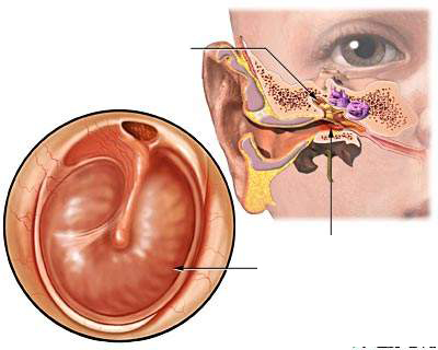 Viêm tai giữa là căn bệnh nguy hiểm nếu không được chữa trị kịp thời