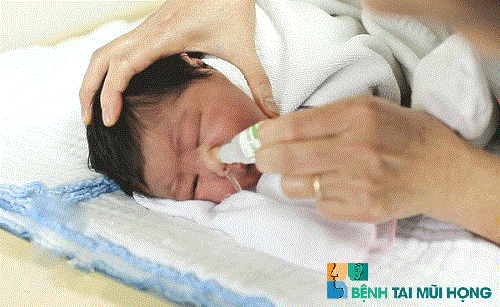 Rửa mũi cho trẻ sơ sinh