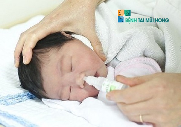 Nước muối là cách trị nghẹt mũi cho trẻ sơ sinh vừa phổ biến, lại an toàn. 