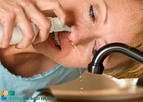 Bị viêm xoang nên rửa mũi bằng nước muối sinh lý