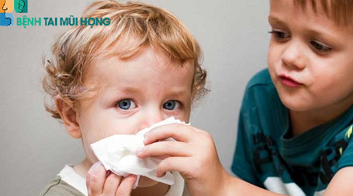 Trẻ bị viêm xoang thường sổ mũi, ngạt mũi