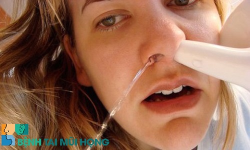 Cách rửa mũi chữa viêm xoang an toàn hiệu quả phải nghiêng đầu 45 độ