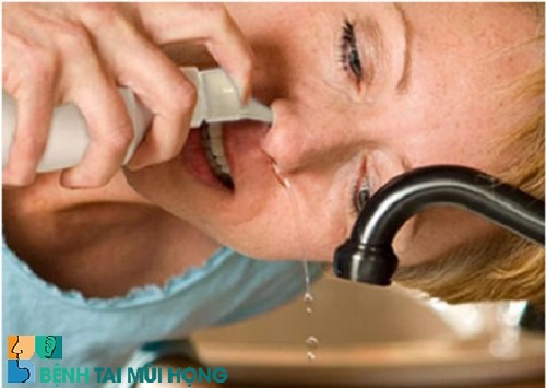Viêm xoang nên thường xuyên rửa mũi bằng nước muối