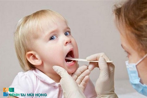 Vệ sinh răng miệng cho bé thường xuyên để hạn chế vi khuẩn