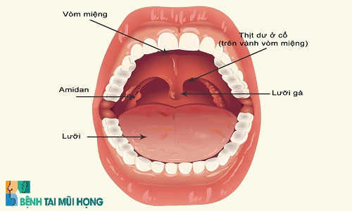 Vị trí của amidan trong vòm họng