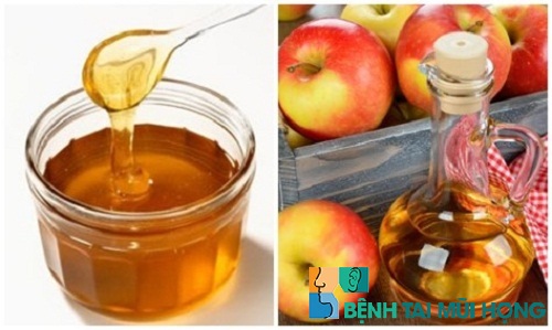 Giấm táo kết hợp mật ong có thể chữa bệnh viêm xoang