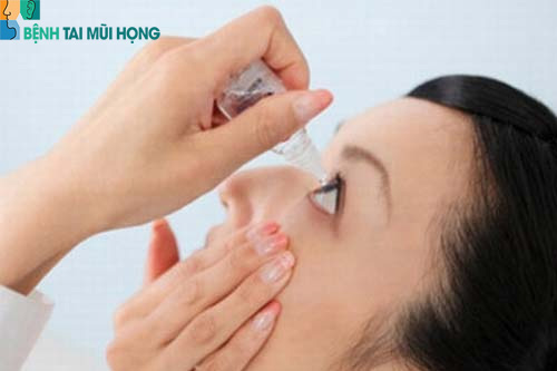 Thuốc nhỏ mắt chứa chất ổn định tế bào mast giảm viêm kết mạc