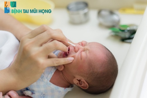 Điều trị nghẹt mũi do nước mũi ở trẻ 2 tháng tuổi bằng nước muối sinh lý