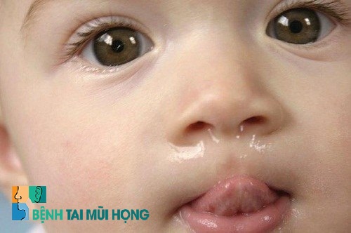 Trẻ 2 tháng bị sổ mũi là do đâu?