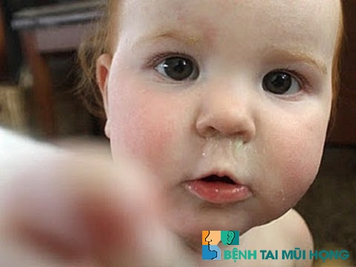 Nếu trẻ bị sổ mũi xanh nhiều ngày không khỏi cần đưa đi khám ngay