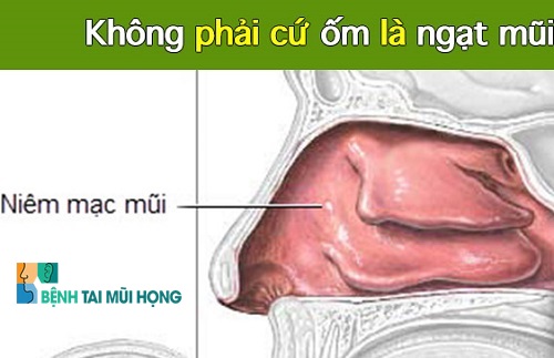 Tình trạng ho và nghẹt mũi ở trẻ sơ sinh có thể do nước nhầy bào thai chưa được hút sạch.