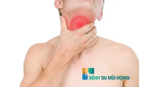 Biểu hiện của triệu chứng đau họng kéo dài
