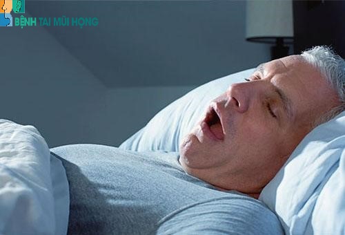 Ngưng thở khi ngủ là một biến chứng vô cùng nguy hiểm của viêm amdian phì đại