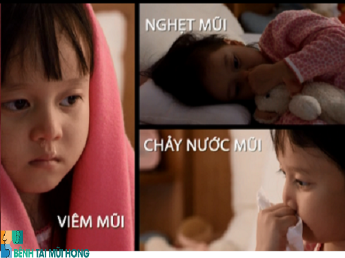 Triệu chứng viêm mũi dị ứng ở trẻ