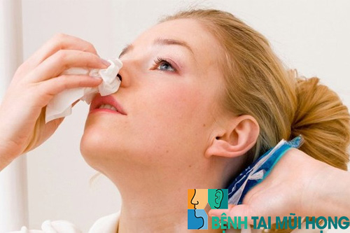 Người bệnh viêm mũi xoang có biểu hiện chảy dịch mũi hoặc dịch họng