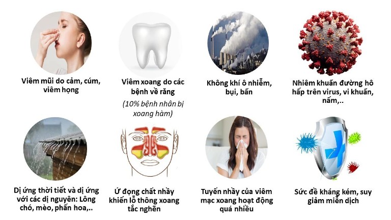 Nguyên nhân gây viêm xoang