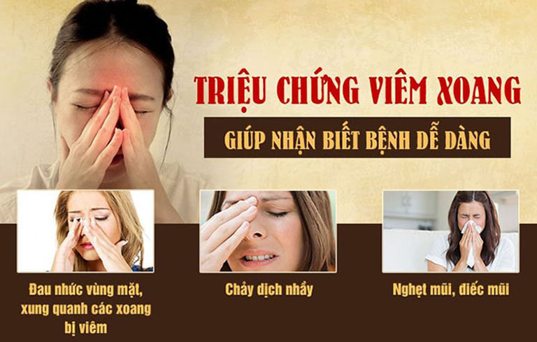 Các triệu chứng viêm xoang