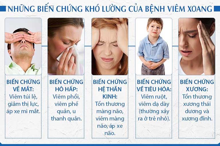 Những biến chứng của bệnh viêm xoang